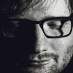 Ed Sheeran herpes zoster dengan kondisi terbaru