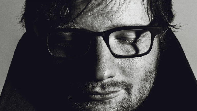 Ed Sheeran herpes zoster dengan kondisi terbaru